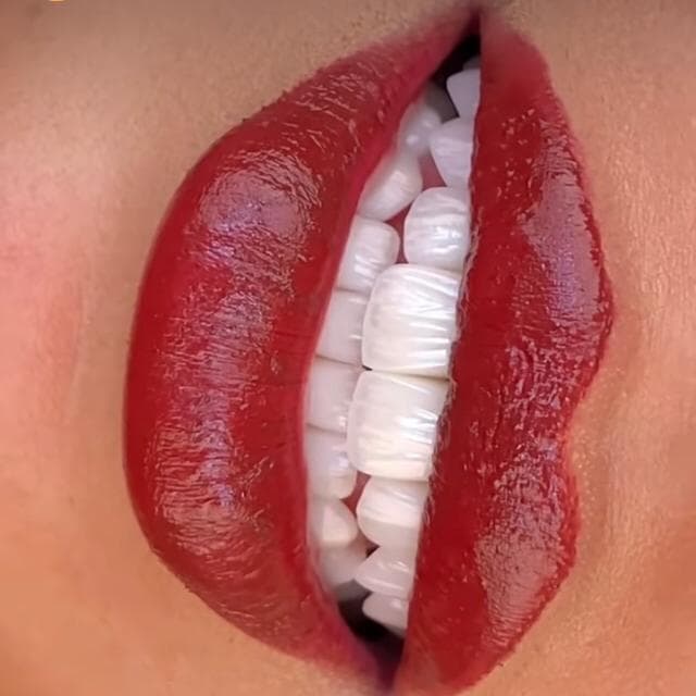 Depois — Resultado real